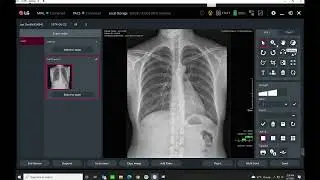 LG DR System v3.0 AWS Acquire Tutorial