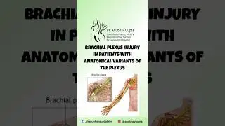 Brachial Plexus Injury in Patients with Anatomical Variants of the Plexus | Dr. Anubhav Gupta
