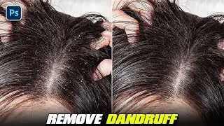 how to remove dandruff from hair in photoshop | One click remove dandruff from hair in photoshop