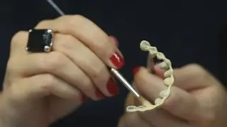 Bridge dentaire [cr&eacute;ation] - Endurance Implant Hongrie