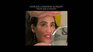 Finance Option For Hairline Lowering Surgery?! | Hey Halo & Greg Bran