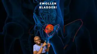 Swollen bladder - Reacting to BBCs junior doctors #doctorreacts