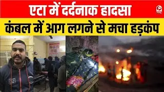 Etah News : एटा में दर्दनाक हादसा,जलती मोमबत्ती से लगी आग,परिवार के 4 लोग झुलसे || Fire Accident