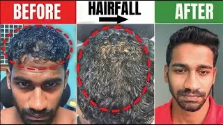 How to STOP HAIR FALL NATURALLY | REGROW Hair | Hair fall Control |  Dandruff | TAMIL ( Men & Women)