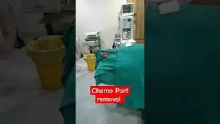 chemo port removal #chemotherapy #patient #icu #hospital #shorts #nursing #care #2024