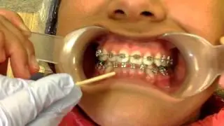 The Orthodontic Appliance