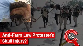 FACT CHECK: Does Image Show Protesting Farmer's Skull Injury from Lathi Charge?