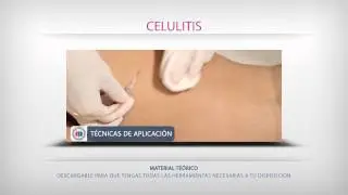 CURSO MEDICO DE CARBOXITERAPIA