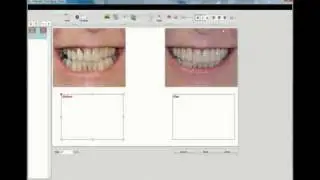 CHAIRSIDE Patient Education - Making a New Presentation
