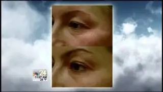 Better Living: Luxe Laser Center