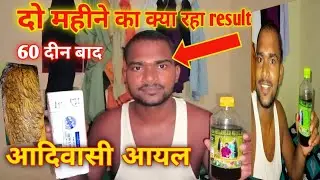 2 महीने बाद# कैसा😭 रहा रिजल्ट#😔 फुल वीडियो ।।आगे देखें😭 viral #vedio
