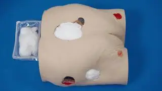 Bridging Two Wounds - Medela Invia® Gauze Dressing Application