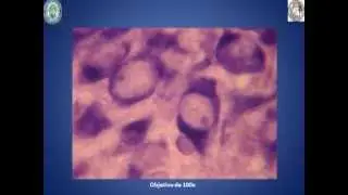 NUCLEOLO
