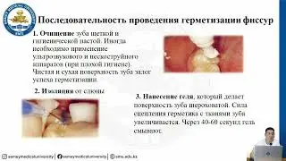 Герметезация фиссур с слепых ямок