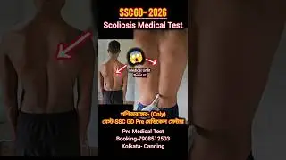 SSC GD- Scoliosis Medical Test #sscgd #crpf #bsf #army #agniveer #shorts #trending