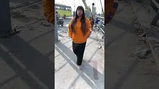 Before Acid Attack | after acid attack | Reshma Khatun Acid Survivor | #shots #sad #emotional