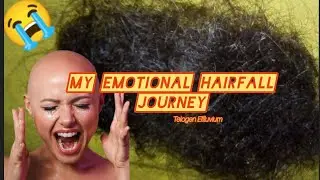 My Hair Loss & Regrowth Journey | I Was Bald After Dengue Fever | Telogen Effluvium @MrBeast
