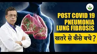 Post Covid 19 Pneumonia Lung Fibrosis खतरा से कैसे बचे? जाने By Dr Sandeep Bhasin