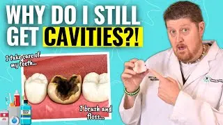 Why You&rsquo;re Getting Cavities Even with Perfect Dental Care
