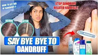 Best anti-dandruff shampoo in the market| how to get rid of dandruff completely 