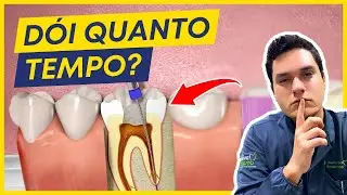 QUANTOS DIAS O DENTE DÓI DEPOIS DE TRATAR O CANAL?