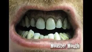Monster Mouth