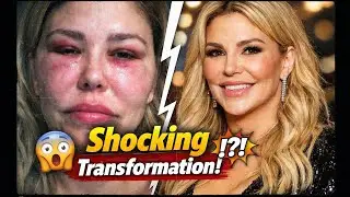 Brandi Glanville&rsquo;s Shocking Transformation After Health Struggles | Full Story