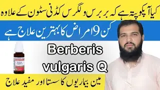 Iconic Homeopathic Medicine Berberis Vulgaris || Berberis Vulgaris Uses in Hindi