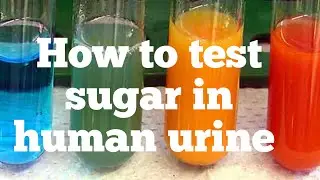 Benedict's test for reducing #sugar।।