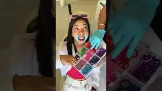 Ustedes tienen o han tenido brackets? cuanto tiempo? 🤣🫶  @seleneguzmanh