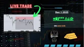 Live Trade With ICT  Concept DRT | Forex Amharic | Ethiopia Forex ክፍል 33  | Sura Trading