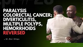 PARALYSIS COLORECTAL CANCER; DIVERTICULITIS, MULTIPLE POLYPS, HEMORRHOIDS REVERSED