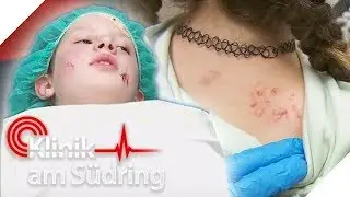 Schlaganfall mit 11! Behält Nele bleibende Schäden? | Klinik am Südring | SAT.1