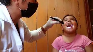 3  EXPLORACIÓN SEMIOLÓGICA DE LA BOCA y PARES CRANEALES