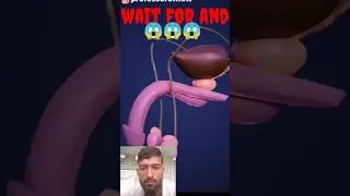kinner kaise paida hote 😜 how to transgender  are born 3D animation #short #youtubeshorts #yt short