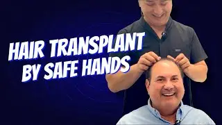 Watch a Full DHI Hair Transplant After a Previous FUT Surgery