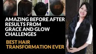 Amazing before After Hair Transformation Results From Grace & Glow Challenges/Get Long & Thick Hair