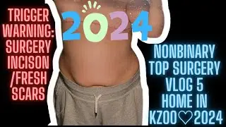 Vlog 5: Nonbinary Top Surgery Recovery & 2024 started