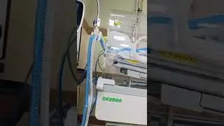 Preterm Baby on Ventilator | 0.78 kg Baby Struggling to Breathe | NICU Real Life