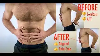 Pilates Imprint vs Neutral Spine | Core Stability Explained | Reduce Back Pain from Lordosis or APT
