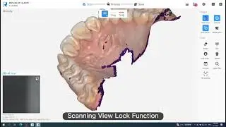 Revolutionize Your Dental Practice with Fast, High-Precision 3D Color Scanning