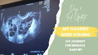My Ovaries Were Kissing Each Other | Day 8 IVF Ultrasound Update