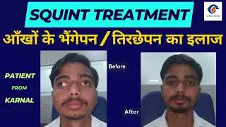 भेंगेपन का इलाज, Strabismus Surgery Or Squint Surgery Treatment Happy Review Patient Review Karnal