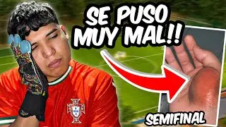 JUGU&Eacute; LA SEMIFINAL DE PORTERO CON LA MANO FRACTURADA Y ESTO PAS&Oacute;... 😱 Sebas