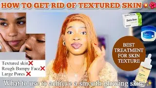 HOW TO GET RID OF TEXTURED SKIN + Products To Permanently Smoothen Rough Bumpy Face & Large Pores