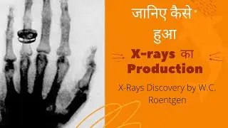 Production of X-rays || Lecture - 1 | RADIATION PHYSICS | Disvovery of X-rays | Properties of X-rays