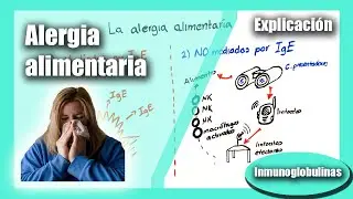 ¿Qué son las alergias a los alimentos? Inmunoglobulina E (hipersensibilidad)
