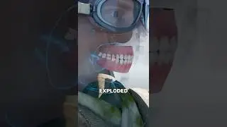 His Tooth Exploded Mid Flight 🦷✈️
