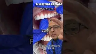 Why It&rsquo;s IMPORTANT To Floss Your Teeth and Dental Bridge | View Mobile Dental #shorts