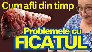 Cum afli din timp că ai Probleme cu FICATUL: 13 semne timpurii